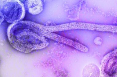Ebola